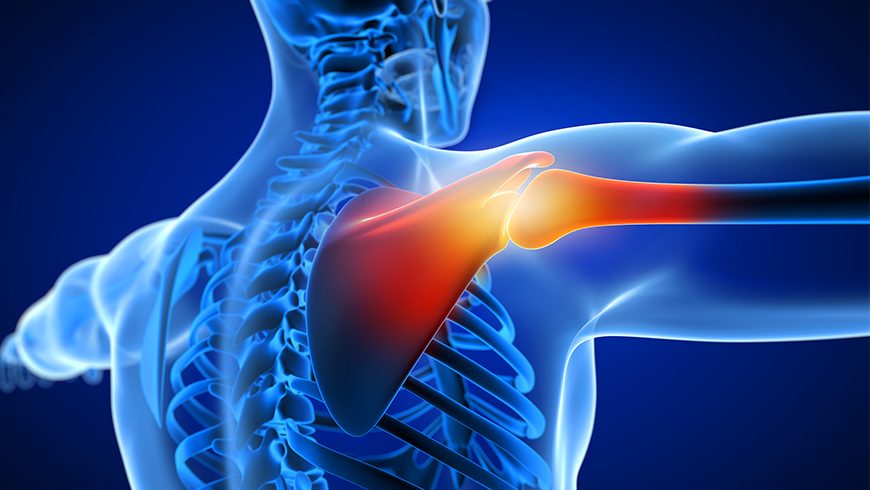 Shoulder Pain